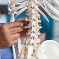 Live Oak Spinal Cord Injury Lawyer